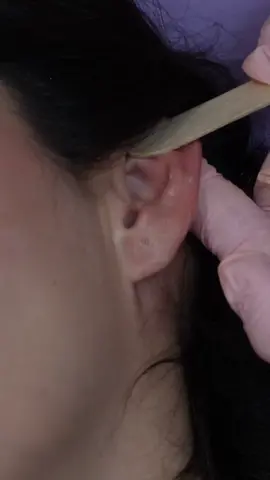 ASMR part 21: most intense face exam for , ear & nose cleaning, acupressure | most intense sharp or dull tests medical roleplay for sleep #madpasmr #asmrhead #asmrface #asmrfacetouching #asmrmedical #asmrmedicalroleplay #asmrmedicalexam #asmrdoctor #asmrdoctorroleplay #asmrrealperson #asmr #asmrsounds #asmrsensory #asmrroleplay #asmrvideo