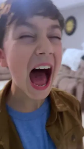 When You Stub Your Toe #tiktok #shorts #reels #hit #toe #finger #fyp #foryou 
