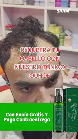 Dile adiós a la caída del cabello con el tónico OUHOE, recupera tu cabello y recupera tu confianza, pide aquí 👉 998719140, hacemos envíos a todo el Perú. #delivery #gratis #peru #cabello #cabellolargo #pelolargo #fyp #fypage 