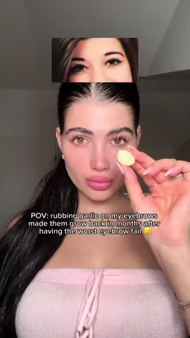 the only thing that could help me grow my eyebrows back after this fail 🥲✨ it stimulates blood circulation & promotes hair growth #beautytips #eyebrows #garlic #fyp #foryou #skintok #beautyhacks #DIY #homeremedy 