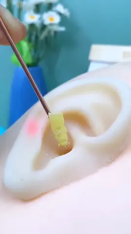 Clear your ears with ease using our earwax removal kit. Hear better, feel better! We deliver all over Lebanon 🇱🇧🚚 ☎️79309663 #EarHealth #EarwaxRemoval #Hygiene #ClearHearing #Comfort