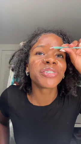 Replying to @emilia turmeric/goat milk soap for darkspots & hyperpigmentation, other than that im using tretnoin. Soap 🔗 in my bio! #pimplepatchremoval #acnejourney #clearskin #skintok #darkspots #turmericsoap 