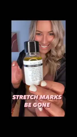 Also works to rid💥 ACNE 💥 ROSACEA 💥 ECZEMA 💥 PSOARSIS 💥SPIDER VEINS 💥 DRY SKIN    📦 FREE SHIPPING FOR AU ORDERS $100+ 📦 🛒 Click link to buy