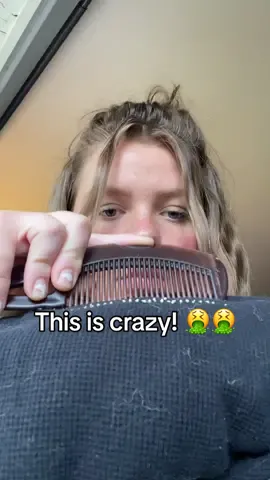 10/10 would recommended to anyone and everyone!🤢🪮  #comb #dandruff #dandruffcontrol #hair #detoxhair #lifechanging #TikTokShop #fy #fyp
