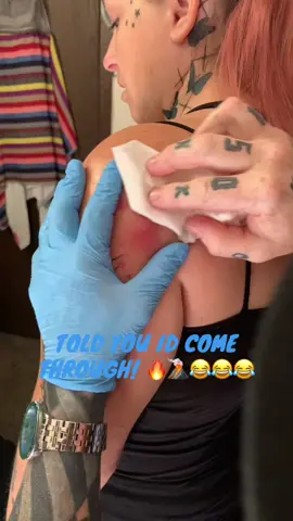 #pop #zit#pimple #pimplepopper #explode 