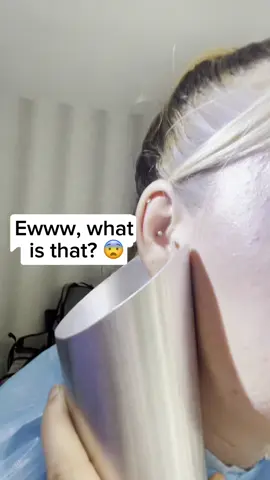 is it possible to do this to my brain? (@clear2hear ) #earcleaningasmr #eww #earcleaning #grossbeauty