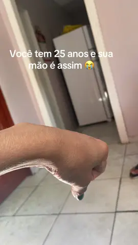 Minha maior insegurança #fyppppppppppppppppppppppp #foryoupage 