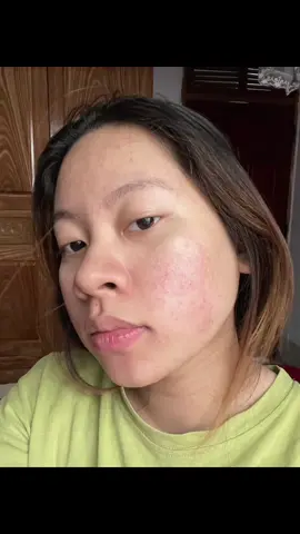 Cố lên nàooo#trịmun #trịmun_an_toàn_lành_tính 