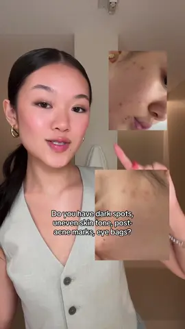 retinal is a powerhouse ⭐️ #ksecretpartner For smooth, bright, even-toned skin on your face, under eyes, neck, try the k-secret retinal serum 🤍 #acnemarks #clearskin #hyperpigmentation 