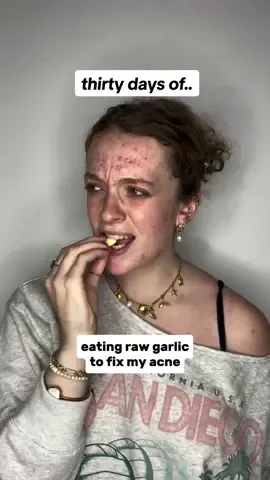 30 days of eating raw garlic to fix my acne 👀💪🏼🧄 what do you guys think? do you see a difference? I feel like my acne really went: 📈📉📈📉📈📉📈 😅  #acne #garlic #acnetreatment #skincare #skincaretips #skincarenatural #skincareroutine #skin #skinhealth #explore #clearskin #clearskintips