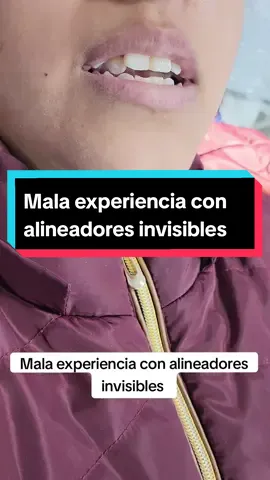 Comparto el caso de una paciente con mala experiencia previa con alineadores invisibles #drmore #ortodoncia #brackets #alineadoresinvisibles 