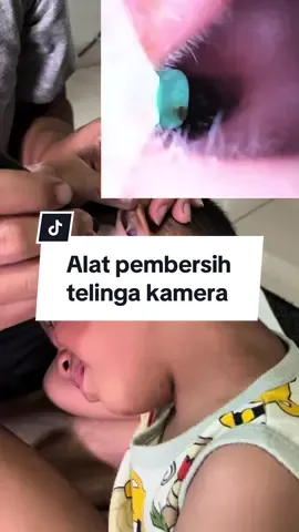 Sekarang udah ga pernah bersihin telinga anak pakai cottonbud lagi sejak ada ini #alatpembersihtelinga #korekkuping #korekkupingkamera 