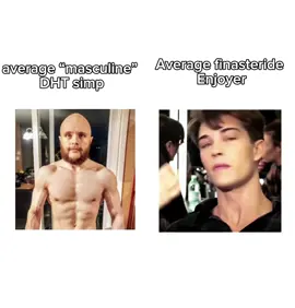 A finasteride a day keeps the hair transplant away #looksmax #blackpil #itsover #mogged #bald #hairloss 