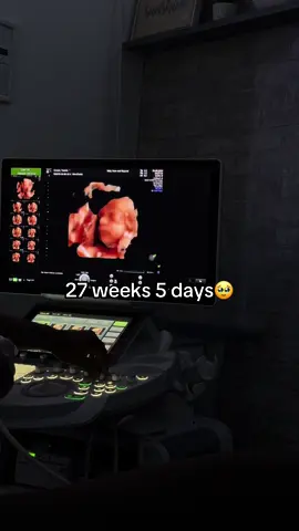 12 week little blob vs my 27 week baby!! His little facial features are so cute 🥹✨🩵  #27weekspregnant #pregnancy #4dscan #mumsoftiktok #mumtobe 