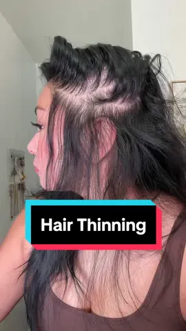 #hairgrowthjourney with @VEGAMOUR ⬇️ I’ve begun to use Vegamour’s GRO+ Advanced Hair Serum and Dermaroller into my daily #haircareroutine to stimulate hair growth✨ It is supposed to help me with my hair density, decrease shedding and nourish from the root. It’s a non greasy formula and can be left in your hair overnight or through your day without weighing down ur hair 🤗 @sephora #vegamourpartner #hairthinning 
