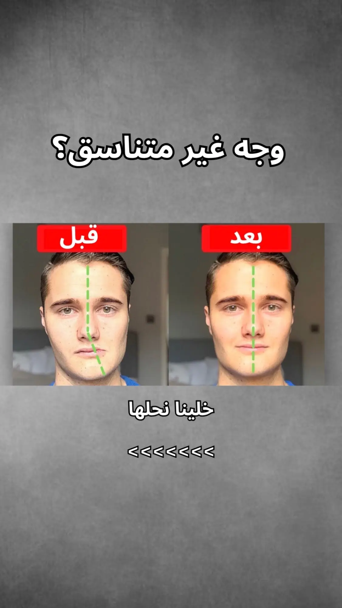 #looksmaxing #facesymmetrycheck #guasha #jawline #hairstyle #GlowUp #looksmax #foryoupage #viral #الهاشتاقات_للشيوخ 