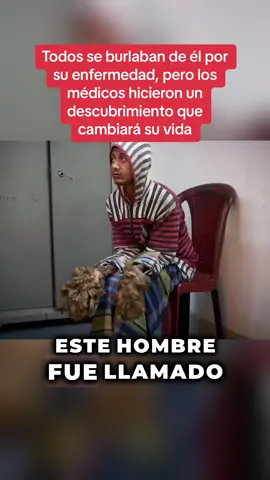 Descubre la emocionante historia de Mark, un hombre con una enfermedad extremadamente rara que lo llevó a ser llamado 'alienígena'. ¿Qué descubrieron los médicos en el hospital? Haz clic en Ver más para saber más sobre esto. #enfermedadrara #historiasemocionantes #resiliencia #Misterio #sorprendente 