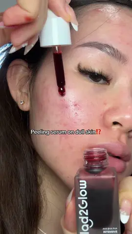 Best 30(ish)k EVER SPENT 🤩‼️ #peelingsolution #G2GPeelingsolution #BHA #exfoliator #peelingserum #exfoliatingserum #exfoliate #skintexture #glassskin #glowingskin 