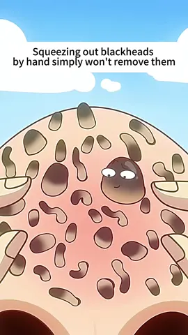 An animation lets you know the importance of skin care for your nose #nose #nosecare #skincare #refinement #fyp #stress #species #pore 