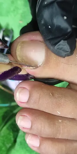 Lấy khoé siêu phê #laykhoe #nails #nail #laykhoemong #laykhoechan #laykhoechuyennghiep #laykhoemongchan #taovamich 