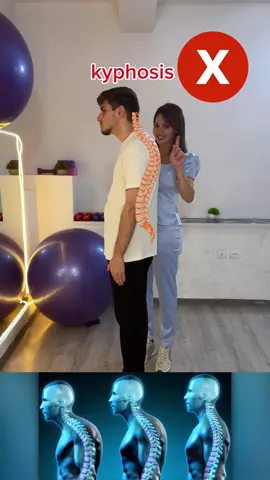 Struggling with Kyphosis? Try These Exercises to Improve Posture! #KyphosisAwareness #postureexercises #spinalhealth #BackPainRelief #PostureCorrection  #HealthAndWellness 