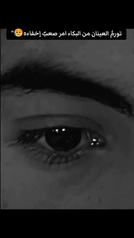 تورمُ العينان من البكاء امر صعبٌ إخفاءه.#شعب_الصيني_ماله_حل😂😂 #تصميم_فيديوهات🎶🎤🎬 #طششونيي🔫🥺😹💞 