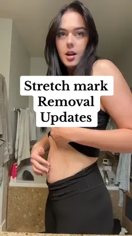 Replying to @Kels heres an update, sorry its not too exciting! #stretchmarks #stretchmarkremoval #microneedling 