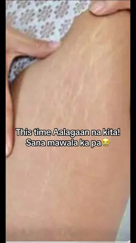 The b3st ka soothing✨😍#soothingoilforstretcmarks #organicskin #fyp #viral 