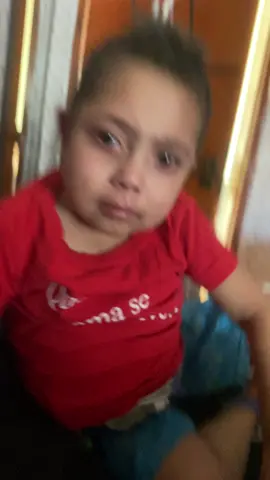 #criancasquelutamcontradoença #doencasraras #maternidadeatípica #hipoplasiacartilagemcabelo #displasiaossea #falenciaintestinal #Dietaprenteral #dietaenteral #cateterperiferico #dietaenteral #catetercentral #nanismo #doencascronicas #imunodeficiência #saudemetal 