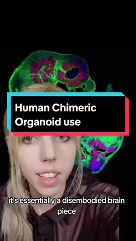 #organoids #brainorganoids #chimera #sciencenews #greenscreenvideo #greenscreen 