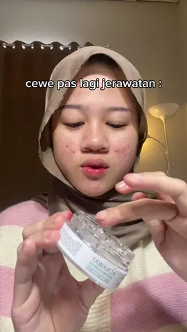 jerawat nya mah 1 doang tp panik nya ada yh #moisturizer #acnaway 