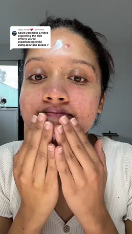 Replying to @Nat ♥️ Accutane hit hard, Respect to those still pushing through. Taking a break, but not giving up. 💪 #accutanejourney #accutanesideeffect #MentalHealth 