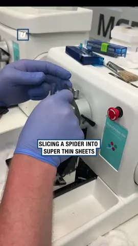 Does this hurt the spider?🕷️@milestonemedical  #spider #doctor #Tech