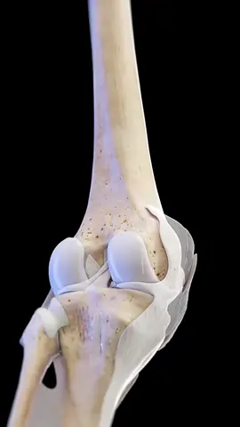 Artrose no Joelho, ou osteoartrite, é uma doença degenerativa que causa o desgaste da cartilagem articular do joelho, levando a dor, rigidez e diminuição da mobilidade.  Causas: - Desgaste Natural: Com o envelhecimento, a cartilagem se desgasta. - Lesões: Traumas repetitivos ou antigos no joelho. - Obesidade: Aumenta a carga sobre as articulações. - Genética: Fatores hereditários podem influenciar. Sintomas: - Dor: Piora com o movimento e melhora com o repouso. - Rigidez: Principalmente ao acordar ou após longos períodos de inatividade. - Inchaço e Crepitação: Pode haver inflamação e sensação de estalos ao mover o joelho. Tratamento: - Conservador: Fisioterapia, medicação, perda de peso e uso de órteses. - Cirúrgico: Em casos graves, procedimentos como artroscopia ou substituição do joelho (artroplastia) podem ser necessários. Embora a artrose no joelho seja uma condição crônica, o tratamento adequado pode aliviar os sintomas e melhorar a qualidade de vida. #artrosedejoelho #artrose #atrite #artrosejoelhos #ar♿️ 