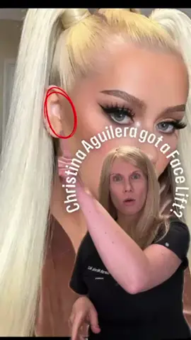 Christina Aguilera’s glow-up is iconic! Let’s dive into the subtle changes that keep her looking ageless. #ChristinaAguilera #FacialPlasticSurgery #CelebrityTransformation #BeforeAndAfter #PlasticSurgery #CosmeticEnhancement #CelebrityGlowUp #BeautyEvolution #AgelessBeauty #FaceLift #Rhinoplasty #CosmeticSurgery #HollywoodBeauty #SurgeryRevealed #CelebritySurgery #TikTokBeauty