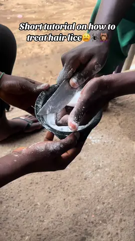 #hairtreatment#lice#hairlice#hairgems#fypシ゚viral🖤tiktok☆♡ #viralvideo #viral #treatment#protectivestyles #nigeria #africa #oliveoil 