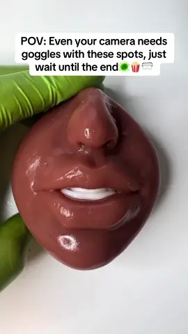 POV: Even your camera needs goggles with these spots, just wait until the end🥽🦠😳 #pimplepop #pimple #asmr #asmrsounds #skincare #squeezing #satisfying #asmrvideo 