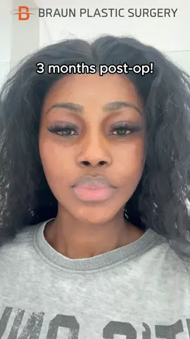 My jaw dropped to the floor when I saw the result…😦😱🫨 . Surgeries she got: 💀 Facial Contouring Surgery, Facial Liposuction, Face lift 👃 Rhinoplasty Surgery . #fyp  #foryourpage  #GlowUp  #femaleplasticsurgery #maleplasticsurgery  #facialfeminizationsurgery #transformation  #beforeandafter  #rhinoplasty #rhinoplastykorea  #nosejob  #facialcontouring  #doubleeyelidsurgery  #doubleeyelid #idol #skincare #botox #filler #lifting #skinbooster #plasticsurgery #braunps  #plasticsurgeryinkorea #realreview #seoul 