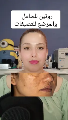 #hyperpigmentation #pigmentation #treatment #beauty #skin #skincare #skincareroutine #skincaretips @TheINKEYListUS @Geek & Gorgeous #arab #tiktokdeutschland #tiktok 