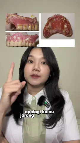 Ini dia cara membersihkan alat alat lepasan di dalam mulut seperti gigi palsu lepasan dan clear aligner dari @drg.joce 😉 Ternyata cara membersihkannya cukup mudah loh. Jangan lupa dicatat ya! ✍️ #gigipalsu #gigipalsulepasan #aligner #pembersihgigipalsu 