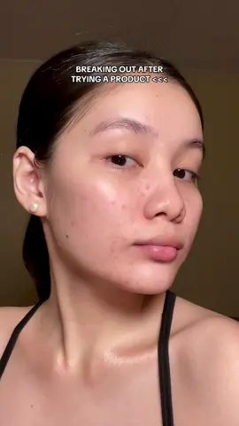 Discovering a skin tint that’s gentle on my skin and keeps breakouts at bay—my new favorite! 💯💕 #dazzlemeph #dazzlemeacnearmor #dazzlemeskintint #makeup #beauty #fyp 