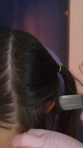 ASMR part 30: scalp Check for  @KaseyCASMR | sharp or dull tests medical roleplay for sleep #madpasmr #asmrhead #asmrface #asmrfacetouching #asmrmedical #asmrmedicalroleplay #asmrmedicalexam #asmrdoctor #asmrdoctorroleplay #asmrrealperson #asmr #asmrsounds #asmrsensory #asmrroleplay #asmrvideo