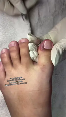 💓 #namthipnails #ตัดเล็บขบ #ตัดหนัง #ทำเล็บ #ร้านตัดเล็บขบ #ร้านตัดเล็บขบราม2 #ร้านทําเล็บ #เล็บขบ  #เล็บเชื้อรา Fb : namthipnails  Line : @namthipnails  นัมเบอร์วัน8 ตลาดม.ราม2  กทม  Map: namthipnails  https://goo.gl/maps/JmwpCKLfKwmhKGK96  ร้านเปิดทุกวัน เวลา12.00น-22.00น.