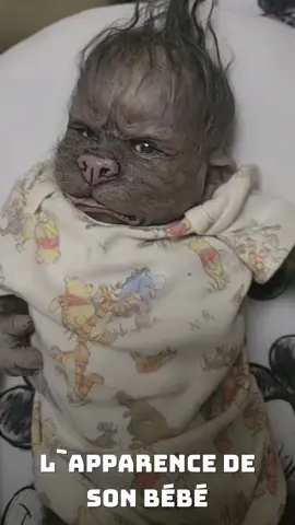 Son père l'abandonne parce qu'il ressemble à un extraterrestre mais 7 ans plus il va le regretter. #histoirevrai #ApprendreSurTikTok #pere #choquant😱 