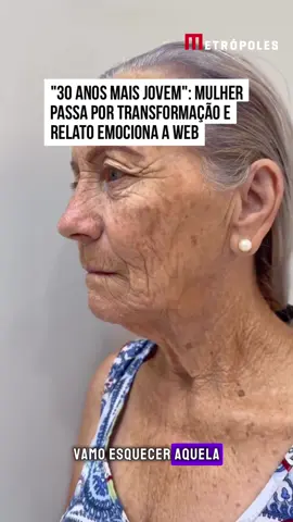 😮 Uma mulher #emocionou os internautas ao compartilhar um relato de gratidão após passar por um procedimento de #rejuvenescimento que, segundo ela, a fez se sentir 