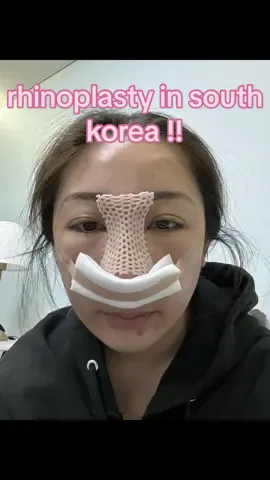 10/10 recommend a nose job in south korea ! #southkorea #rhinoplasty #traveltiktok #nosejobcheck #korea 