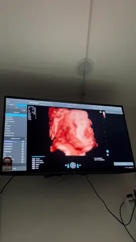 Counting days ♥️ #37weekspregnant 