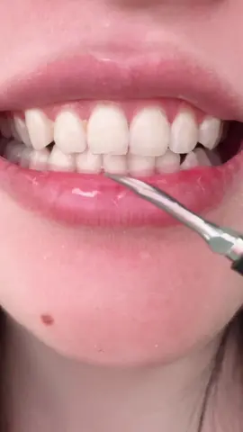 yang tak suka pergi scalling , korang boleh try pakai dental scaler ni. #berusgigielektrik #scalingteeth #teethcleaner #pembersihgigi #oralcare #scallinggigi  #scalinggigi #alatscalinggigidirumah #penjagaangigi #gigiputihbersih #karanggigi #ultrasonicteethcleaning #berusgigielektrik #scalingteeth