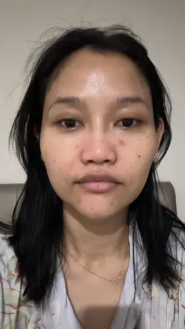 No bengkak no memar 😆