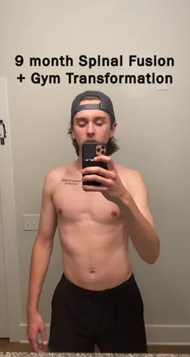 POV you took full advantage of newbie gains: • If only I knew how to pose back then 😩 • This was my 9 month transformation post spinal fusion surgery for my scoliosis. First video was from December of 2021 (a month before I was allowed to start lifting). Last video is from September 2022 (9 months into lifting). • • • If I knew what I do now I would have gained even more! • If you are looking to have a similar transformation, DM me 